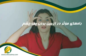 راه_های موثر در از بین بردن پف چشم