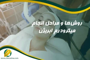 روش_ها و مراحل انجام میکرودرم ابریژن