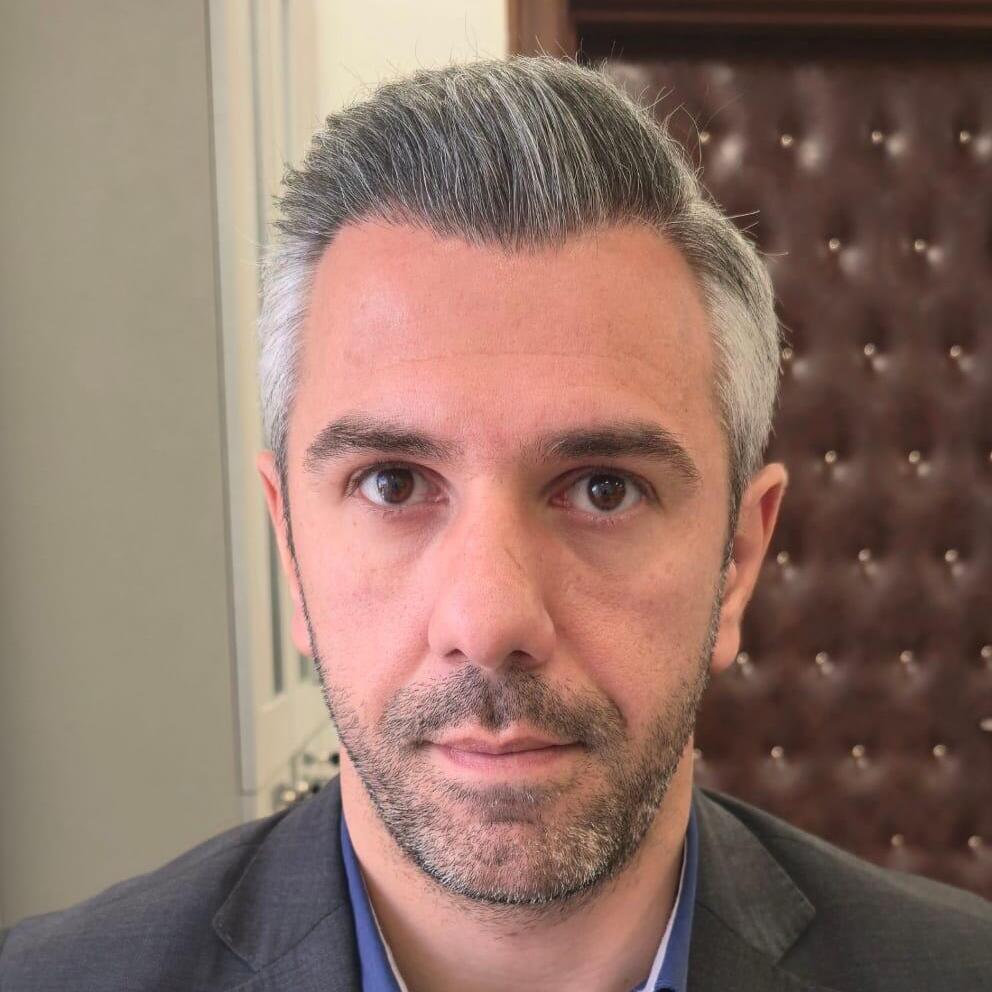 After hair transplant example
