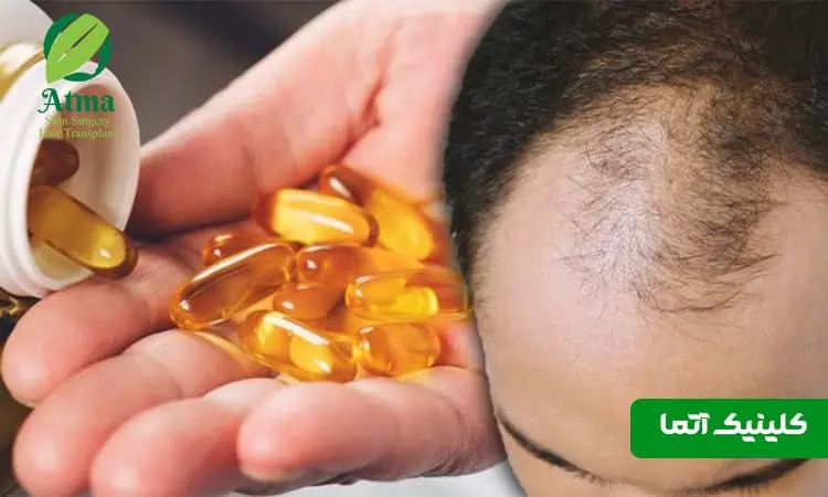 بهترین قرص ویتامین برای ریزش مو