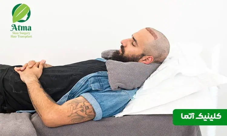 نحوه صحیح خوابیدن پس از کاشت مو