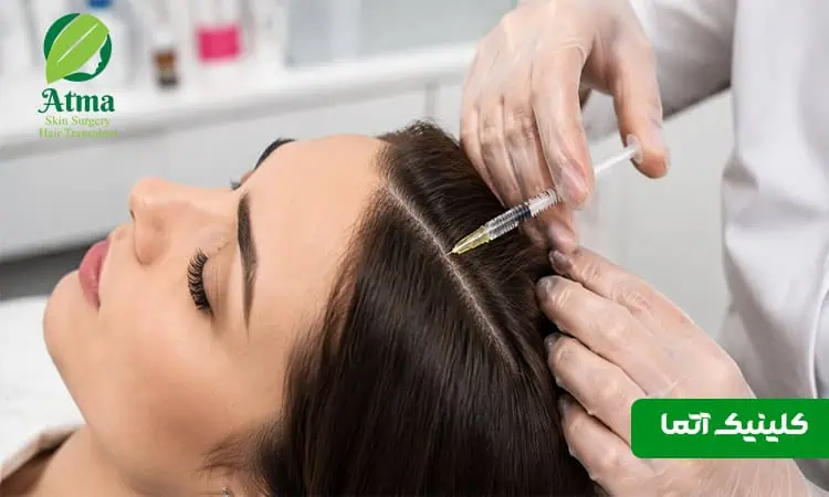 مزوتراپی مو 