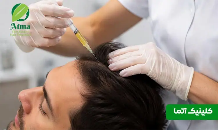 پی آر پی مو بهتر است یا مزوتراپی