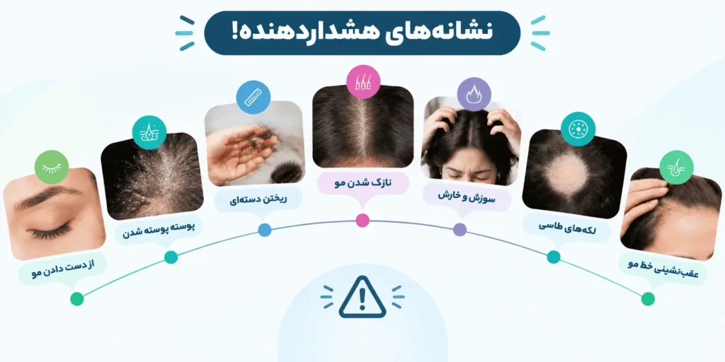 نشانه های هشدار دهنده ریزش مو 